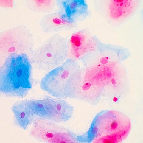 Should I, and Can I Get A Private Smear Test Near Me?