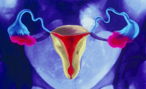 Tiny sling correcting uterine prolapse spares women trauma of hysterectomy